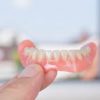 What Can I Get Instead of Dentures? 3 Alternatives to Consider