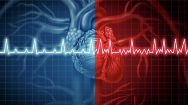 Top Signs To Consider That You Have An Unhealthy Heart