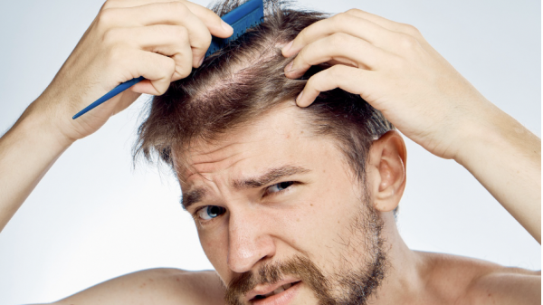 Don't Ignore This Early Sign of Male Pattern Baldness