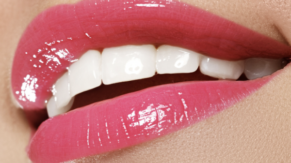 The Pros And Cons Of Teeth Whitening