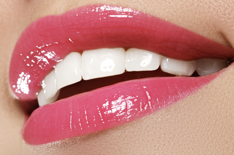 The Pros And Cons Of Teeth Whitening