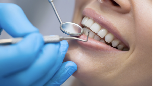 3 Reasons Why Adults Need to go to the Dentist Too