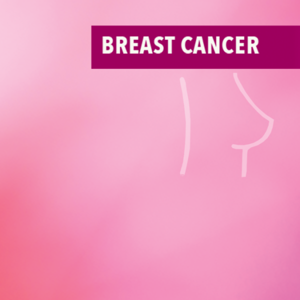 What is the Order of Treatment for Breast Cancer?