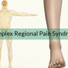 Understanding Complex Regional Pain Syndrome (CRPS)