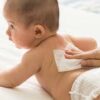 Baby Skincare Tips to Avoid Diaper Rashes & Irritation